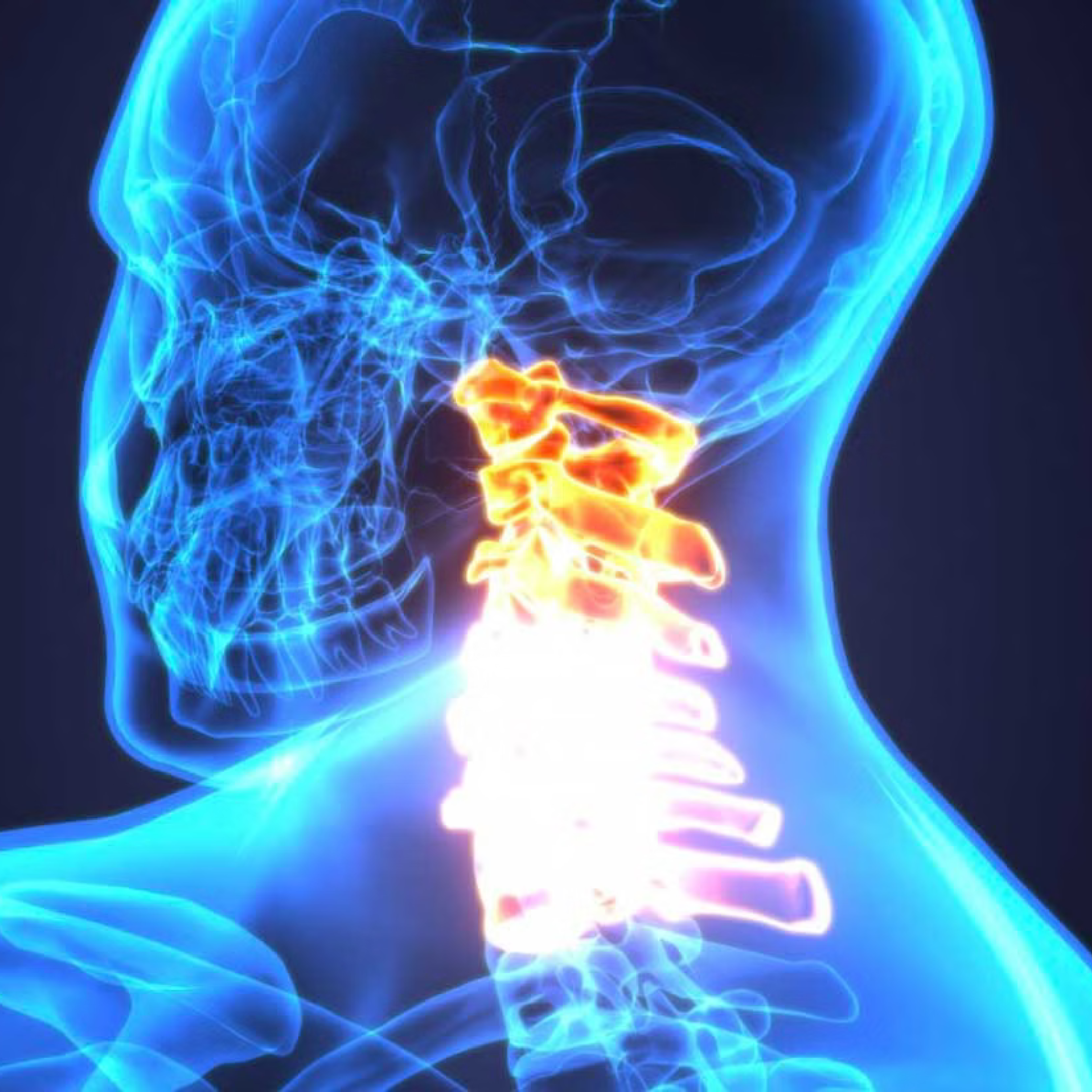 Rayos X de la columna cervical en vista lateral con vértebras resaltadas en naranja, mostrando anatomía del cuello humano para fines médicos.